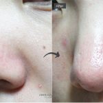 Ciracle_Blackhead_Off_Sheet_Shopanshop_india_2